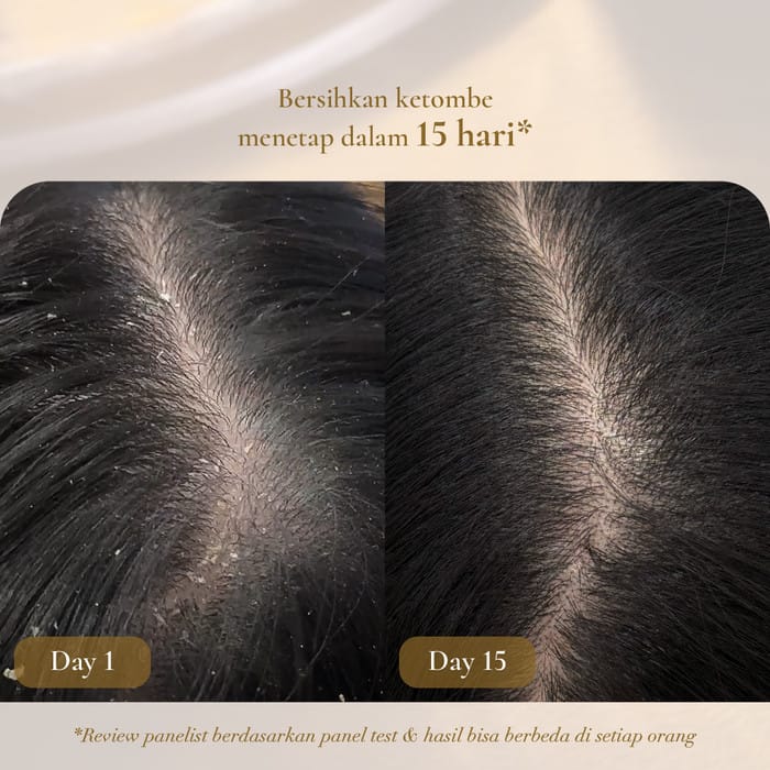 FELAUFEE - Dandruff Treatment Serum Shampoo