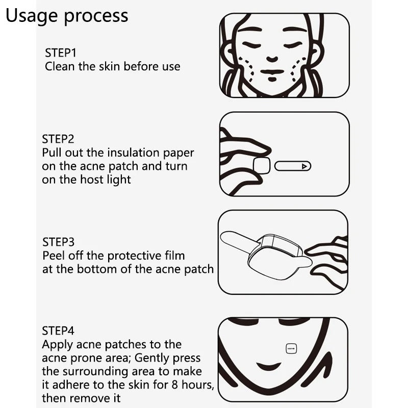 Electronic Beauty Device For Cleansing  And Fading Acne Marks