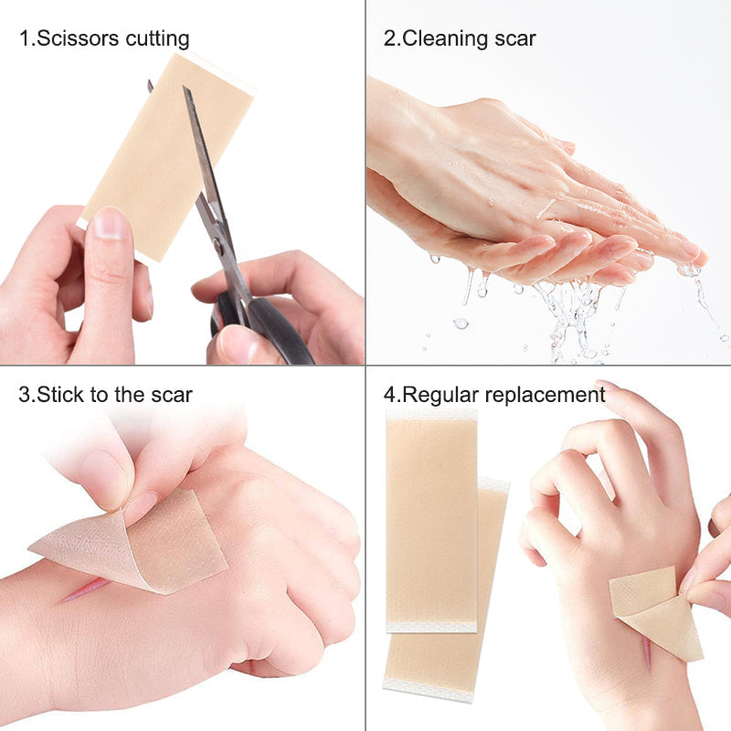 Silicone Gel Sheets for Scar
