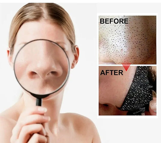 Nose Black Head Remover Strips