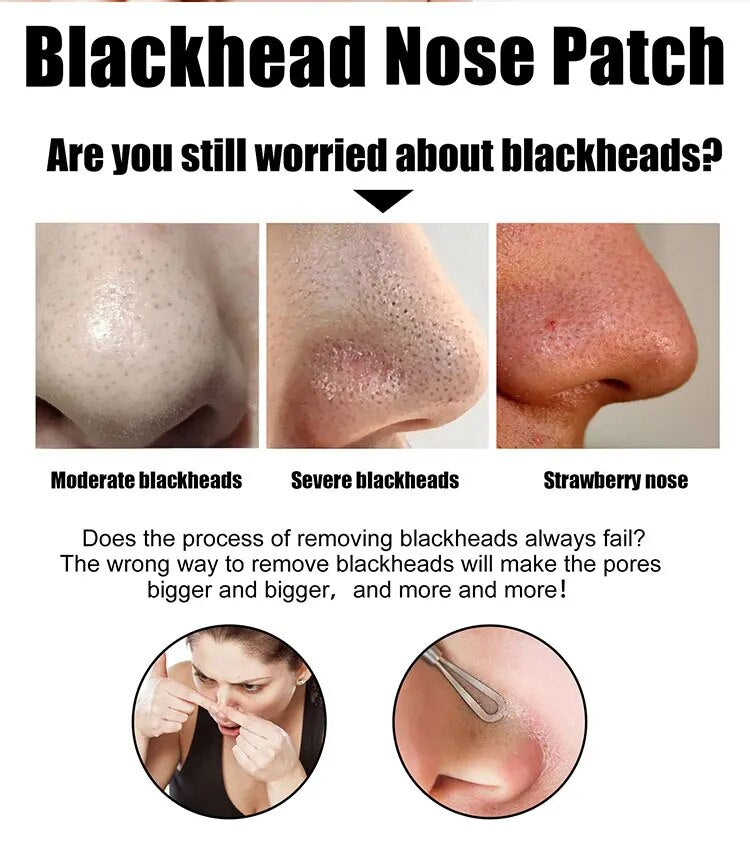 Nose Black Head Remover Strips